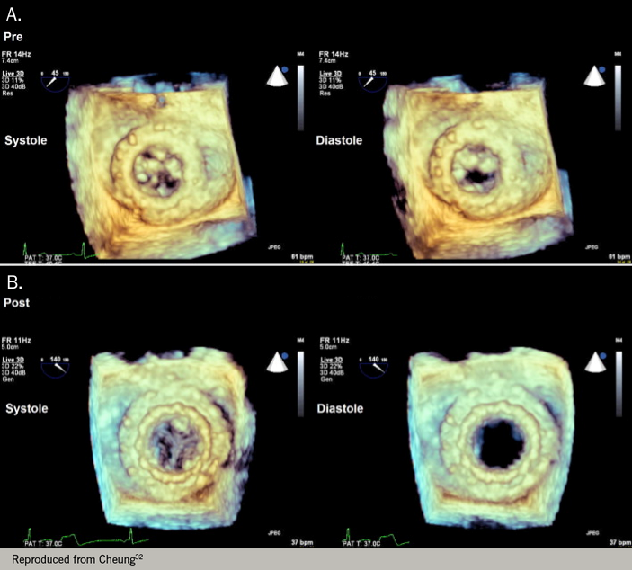 Figure 12 The British Journal Of Cardiology