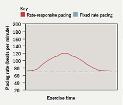 Figure 2. Rate-responsive pacing results in an exercise-induced rise in the pacing rate that resembles a physiological response. The pacing rate declines following exercise cessation until it reaches the programmed basic rate