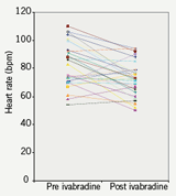 Figure 2. Comparison of heart rate pre and post ivabradine therapy within all 30 patients during follow-up period (up to 12 months)