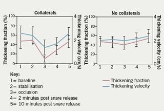 Figure 2. Results of occluding the left anterior descending (LAD) artery on anterior wall thickening during beating heart surgery.