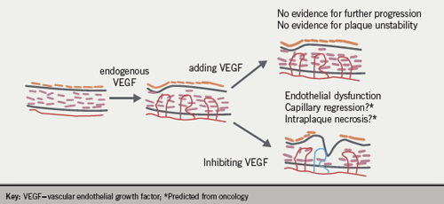 Figure 4. Impact of VEGF on atherosclerotic plaque development and stability