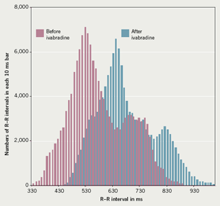 Figure 1. 24-hour R–R interval histogram to show heart rate slowing with ivabradine