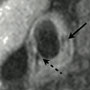 Contemporary coronary imaging from patient to plaque: part 4 magnetic resonance imaging