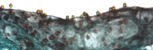 Figure 5. Microparticles of iron oxide (MPIO) bound to the aortic root of apolipoprotein E knockout mice. These particles have a paramagnetic effect, which leads to signal dropout when imaged using MRI