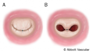 fig 10