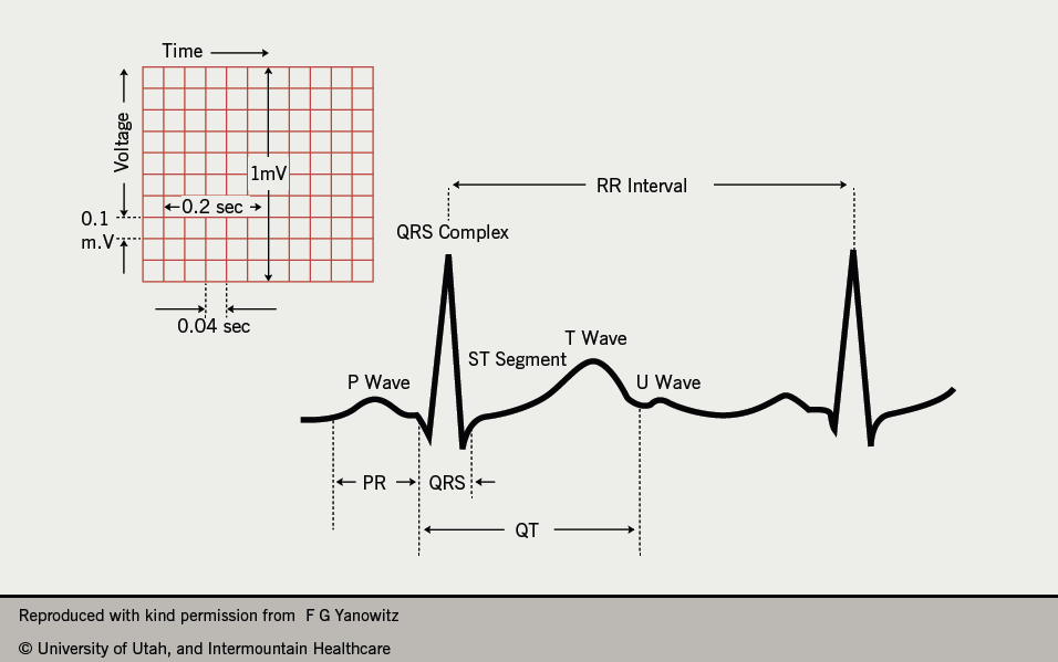 qtc normal range