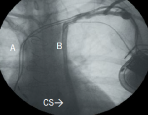 Figure 2b