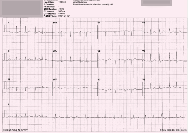 Can We Trust Our Ecg Machines The British Journal Of Cardiology