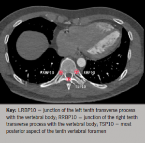 Figure 3. Vertebral points