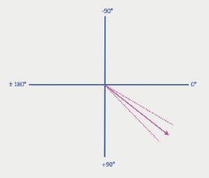 Figure 6. Mean cardiac axis on CT,38.1 ± 7.8° (broken lines demonstratestandard deviation)