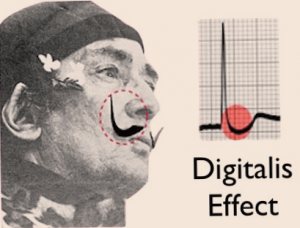 Figure 2. For the digitalis ‘effect,’ remember Salvador Dali