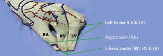 Figure 1. Anterior view: borders along the anterior surface of the heart