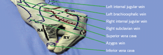 Figure 5. Anterolateral view: great veins of the mediastinum