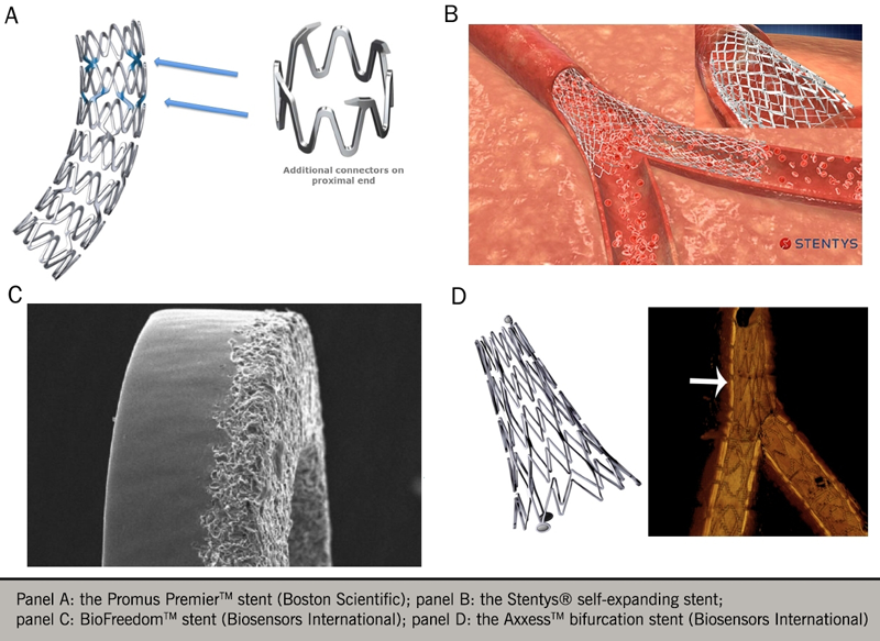 Angina module 7 - Figure 6. Examples of coronary stent technology