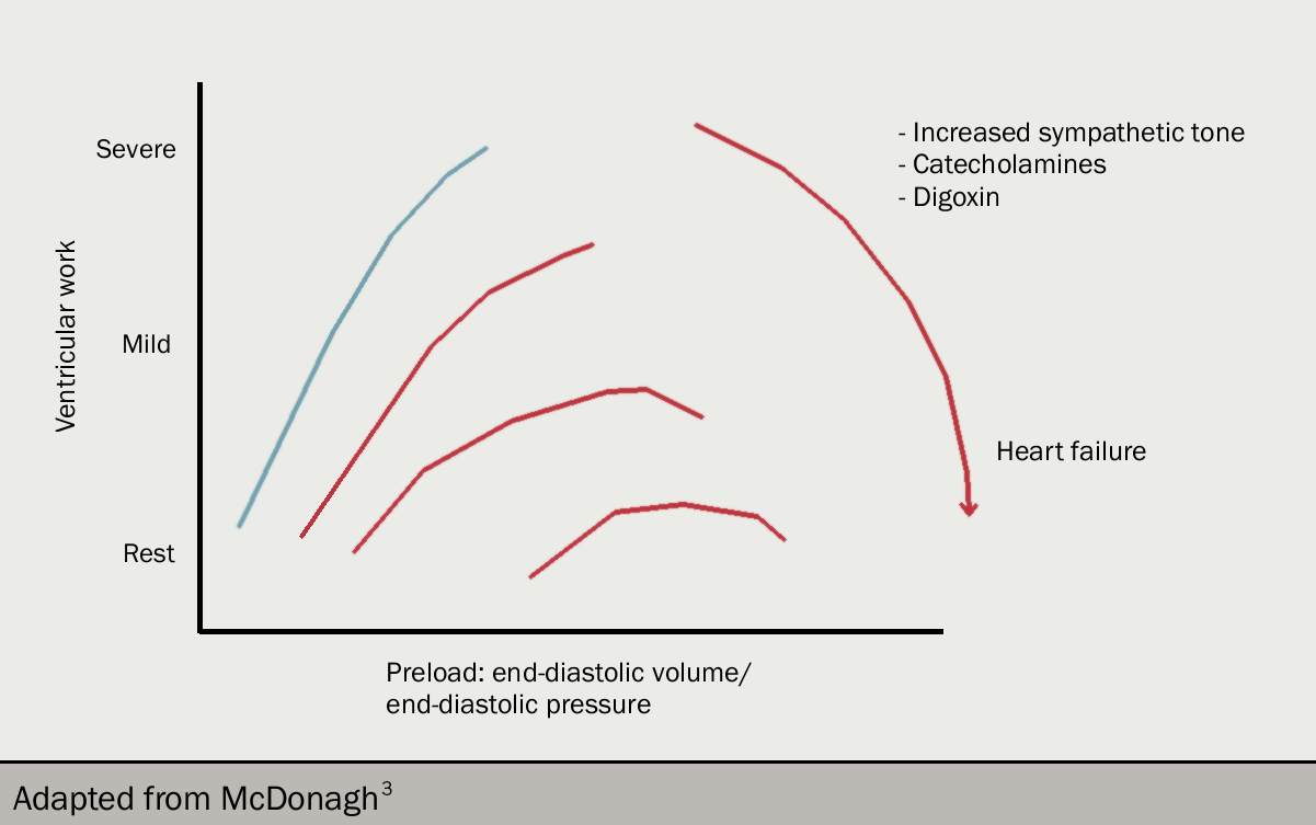 Heart failure module 1 2020 - Figure 10. Starling’s law of the heart. In the normal heart (blue), ventricular work increases as a function of preload. The horizontal lines show the ventricular work required at rest, then for mild and finally severe exertion. With increasing severity of heart failure (brown lines), a greater preload is needed for a given level of activity. Note the ‘descending limb’ of the Starling curve for patients with severe heart failure: the implication is that a reduction in preload might (paradoxically) increase ventricular work