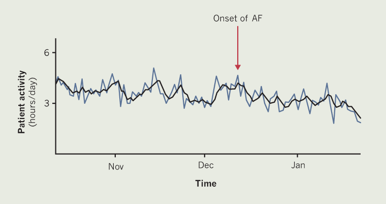 Callum - Figure 1. Daily physical activity collected from a Boston Scientific cardiac resynchronisation therapy pacemaker (CRT-P) device of patient A. The blue line plots daily measurements and the black line provides three-day trends