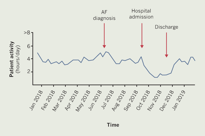 Callum - Figure 2. Physical-activity data collected from the Medtronic CRT-P device of patient B. Only general trend data given (14-month view)