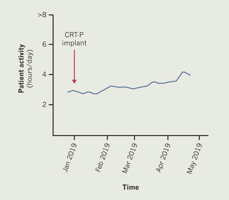 Callum - Figure 3. Physical-activity data collected from the Medtronic CRT-P device of patient C. Only general trend data provided and data recorded since implantation of device