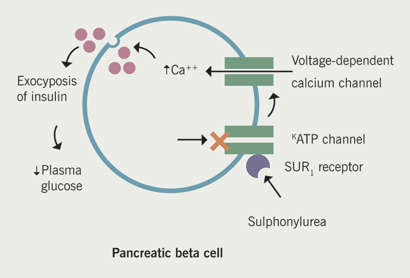 Diabetes module 2 - Figure 2. Mechanism of action of sulfonylureas. After binding to the sulfonylurea receptor (SUR) on pancreatic beta cells, the closure of ATP-K channels is triggered resulting in depolarisation of voltage dependent calcium channels and exocytosis of insulin