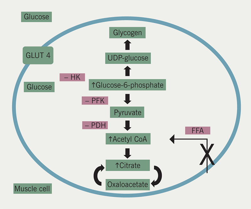 Diabetes module 2 - Figure 3. Oxidation of the free fatty acids (FFA) results in inhibition of pyruvate dehydrogenase (PDH). Citrate inhibits phosphofructokinase (PFK). A rise in glucose-6-phosphate inhibits hexokinase (HK). These effects reduce glucose uptake and utilisation. Thiazolidinediones reduce FFA entering muscle cells thereby increasing glucose utilisation at point X. GLUT4 transcription is also increased leading to increased glucose uptake