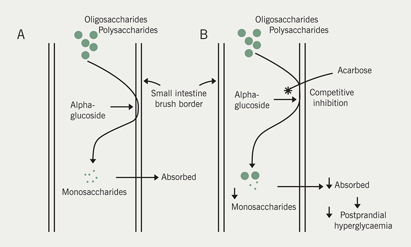 Diabetes module 2 - Figure 4. Mechanism of action of acarbose. Panel A shows polysaccharides and oligosaccharides broken down by alpha glucoside at the small intestine brush border to monosaccharides, which are easily absorbed. Panel B shows acarbose competitively and reversibly inhibits alpha glucoside at the brush border with a weaker effect on pancreatic alpha amylase. The overall effect is the reduction in production and absorption of monosaccharides in the small intestine. In patients with diabetes, this results in a decrease in post-prandial hyperglycaemia