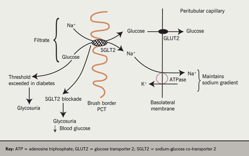 Diabetes module 2 - Figure 6. Sodium-glucose co-transporter 2 (SGLT2) is a high capacity, low affinity transporter of glucose and sodium found in high concentration at the brush border membrane of the S1 and S2 segment of the proximal convoluted tubule (PCT). SGLT2 binds to sodium and glucose in the filtrate and these compounds are translocated across the apical cell membrane. The second stage of reabsorption is the transport of glucose via GLUT 2 transporters in the basolateral membrane. In poorly controlled diabetes, the renal threshold for a glucose reabsorption is exceeded resulting in polyuria and a reduction in blood glucose levels