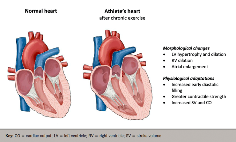 can-too-much-exercise-be-dangerous-what-can-we-learn-from-the-athlete