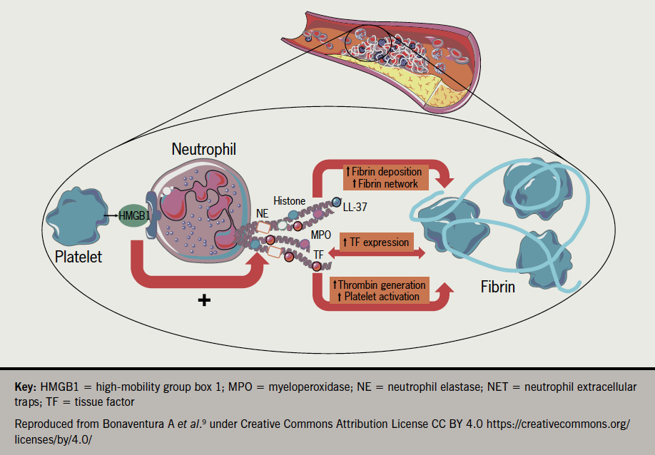 Rees - Figure. 1 The interplay between NETs and platelets. NETs promote thrombosis by favouring fibrin deposition. Recently, a notion has been added by showing that NETs can express tissue factor further triggering thrombin generation and platelet activation and finally increasing the thrombogenic potential of NETs. This was reported especially at the site of plaque rupture during acute myocardial infarction when platelets and neutrophils interact with each other. In this view, activated platelets present HMGB1 to neutrophils and stimulate them to form NETs