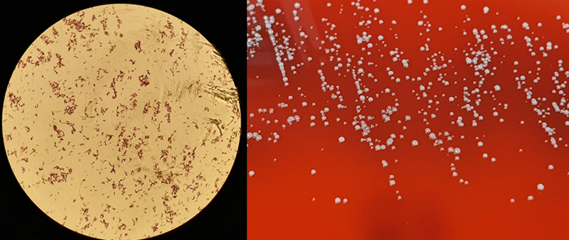 Boyle - Figure 5. Cutibacterium species anaerobic, Gram-positive bacilli