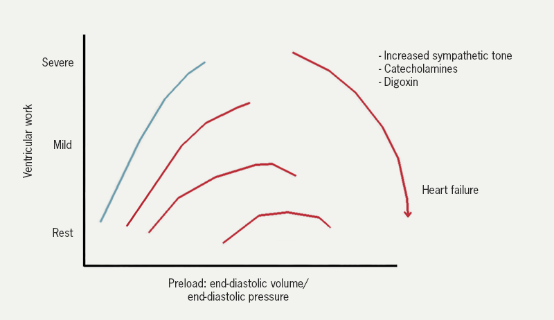 Heart failure module 1 - Figure 10. Starling’s law of the heart. In the normal heart (blue), ventricular work increases as a function of preload. The horizontal lines show the ventricular work required at rest, then for mild and finally severe exertion. With increasing severity of HF (brown lines), a greater preload is needed for a given level of activity. Note the ‘descending limb’ of the Starling curve for patients with severe HF: the implication is that a reduction in preload might (paradoxically) increase ventricular work