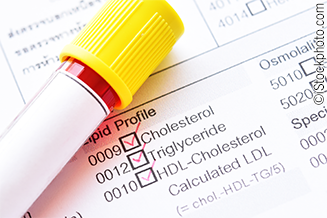 Lipid profile