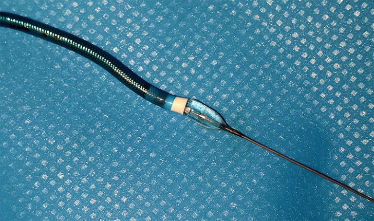 Cardiac catheterisation: avoiding common pitfalls with transradial ...