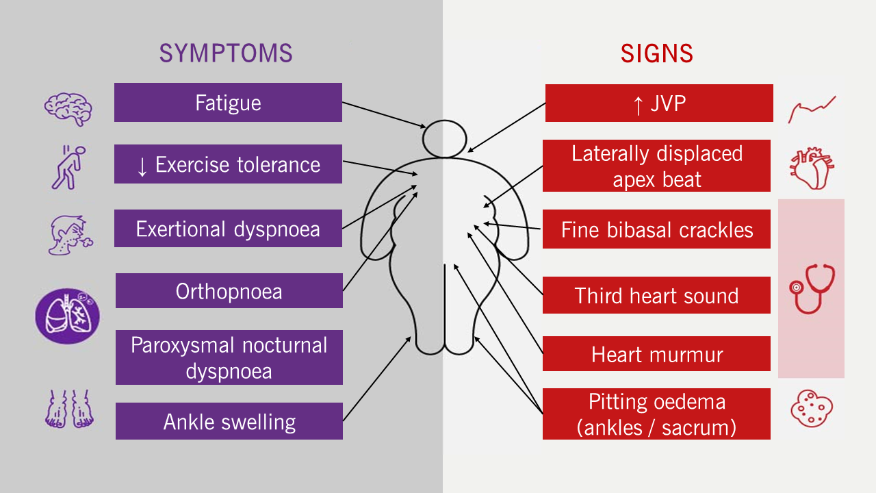 Heart failure module 1 2024 - Figure 1. Typical symptoms and signs of heart failure