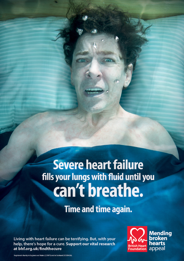 Heart failure learning module 5 - Figure 8. Breathlessness is a particularly distressing symptom for patients with heart failure and their carers