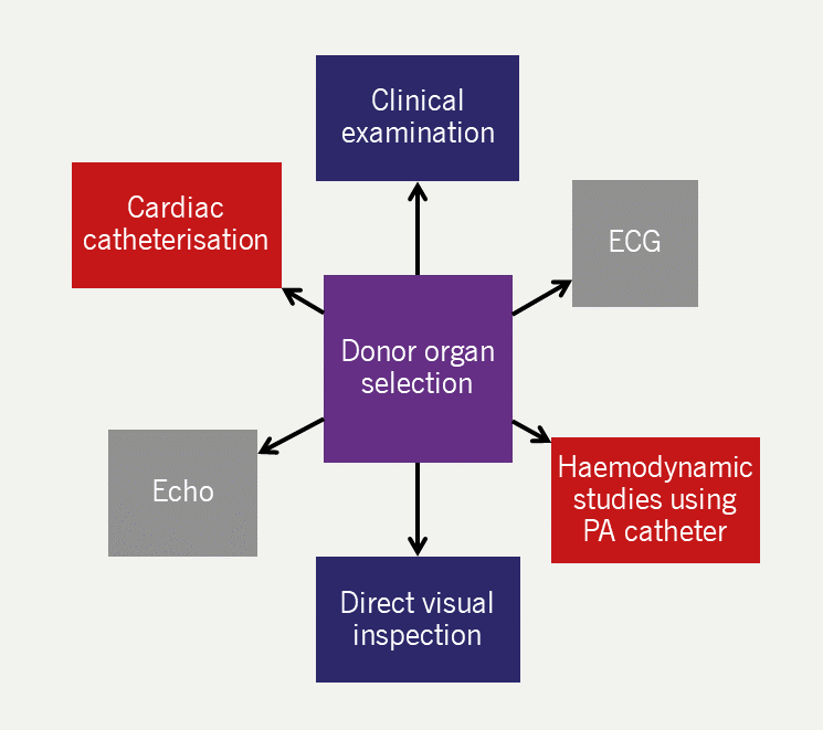 Heart failure module 5 - Figure 4. Key aspects of donor organ selection for cardiac transplantation