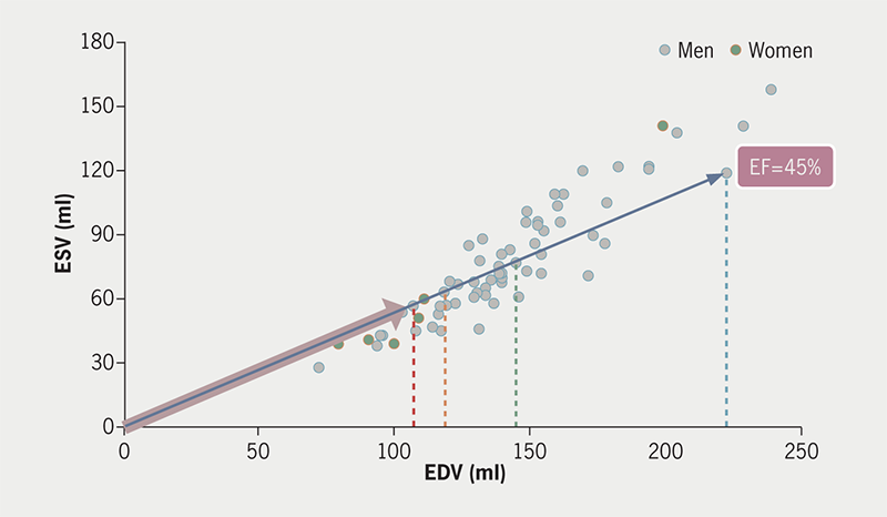 Figure 1A. Volume domain representation of data sets referring to acute myocardial infarction patients. End-systolic volume (ESV) is plotted against end-diastolic volume (EDV). The dark blue line indicates a trajectory with a constant value for ejection fraction (EF), in this case 45%. Four patients satisfy this condition, but can be distinguished by considering the distance from the origin to each individual point. This distance is termed the companion to EF, and denoted as EFC. An example (pink-arrowed bar) is shown for the patient with the smallest ventricle having EF=45%. Four patients (marked by the coloured dotted lines referring to the individual EDV) can be identified with {104, 57}, {115, 63}, {141, 77} and {217, 119} as {EDV, ESV} coordinates. Note that the slope of the dark blue and pink-arrowed lines corresponds with (ESV/EDV). Based on equation 1, this means that EF equals (1 – slope). Thus, a slope of 0.55 translates in an EF of 45% (when expressed as a percentage)