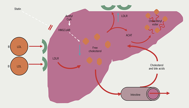 Lipids module 4 - Figure 2. Mode of action of statins