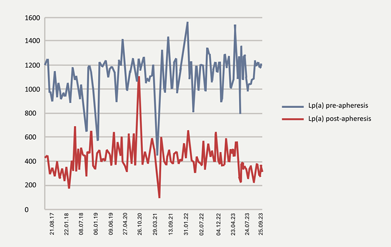 Khan - Figure 1. Case one Lp(a) levels pre- and post-lipoprotein apheresis (LA)