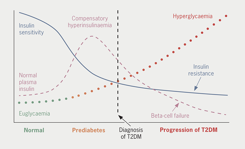 Bailey - Figure 1. Typical progressive natural history of type 2 diabetes (T2DM)