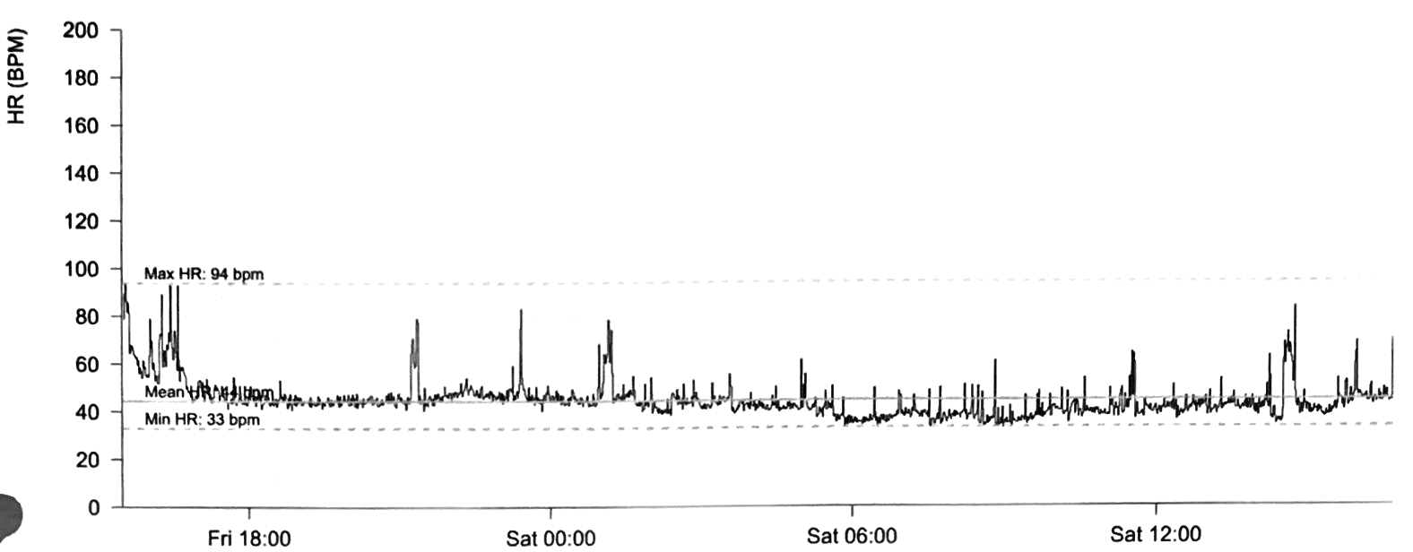 Parameswaran - Figure 3F. Rate histogram from case 2.