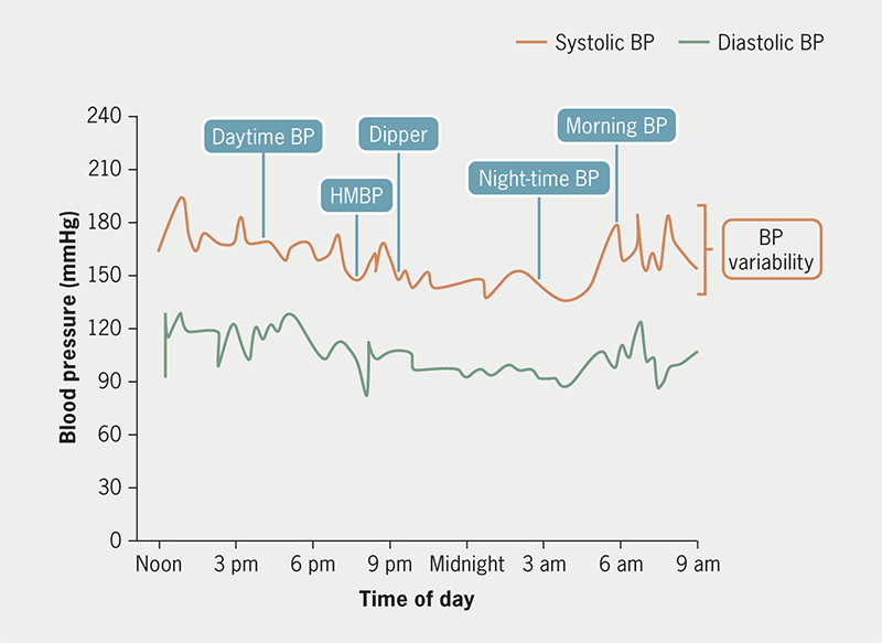 Lai - Figure 1. Short-term blood pressure variability (24 hours)