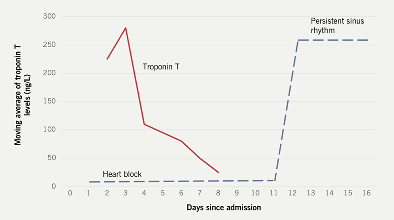 Graham-Hart - Figure 1. Moving average of the case’s troponin T levels (ng/L) and rhythm over time from admission