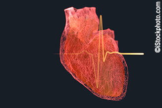 AV nodal ablation, where are we now? Insight from real-world Northern Irish multi-centre registry data