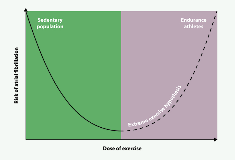 Davies - Figure 1. The extreme exercise hypothesis whereby the benefits of exercise are reduced in extreme training volumes
