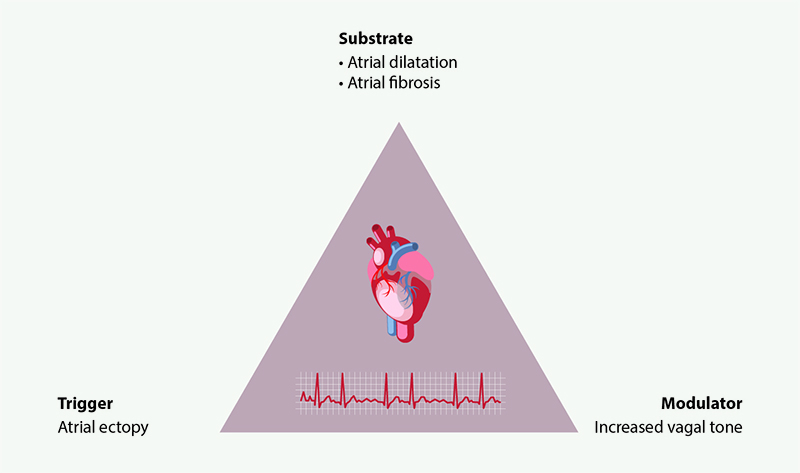 Davies - Figure 2. Coumel’s triangle of arrhythmogenesis