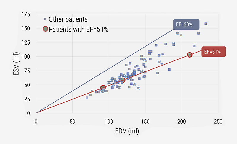 Kerkhof - Figure 2. The volume-regulation graph shows how end-systolic volume (ESV) and end-diastolic volume (EDV) are associated, here for a cohort of 96 cardiac patients, analysed by cardiac magnetic resonance imaging.7,12 The slopes of the (blue and red) lines reflect the constant value found for the ratio of successive data pairs (ESV and EDV), thus, each referring to a fixed value for ejection fraction (EF). Three patients, each marked by a red circle, have the same EF value (namely 51%), yet their ESV and EDV values differ. Thus, EF is not a unique metric