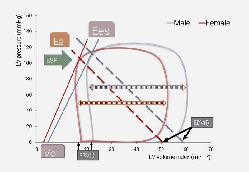 Kerkhof - Figure 4. Schematic presentation of sex-specific left ventricular pressure-volume loops, indicating the primary variables and several derived metrics.1 The width of the loop (see double arrow-head bar) corresponds with stroke volume, and the area enclosed by the loop reflects stroke work