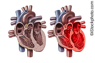 Oflidis - Takotsubo syndrome with concomitant coronary angioplasty and implantable cardioverter-defibrillator implantation- a case report